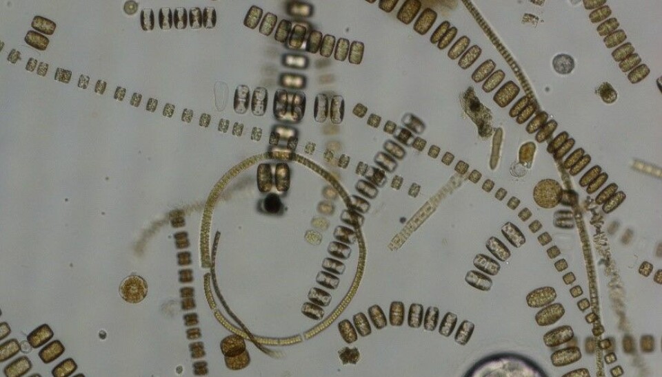 Microscopy picture from an Arctic spring bloom dominated by diatoms.