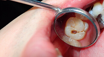 Are some people more prone to getting cavities than others?