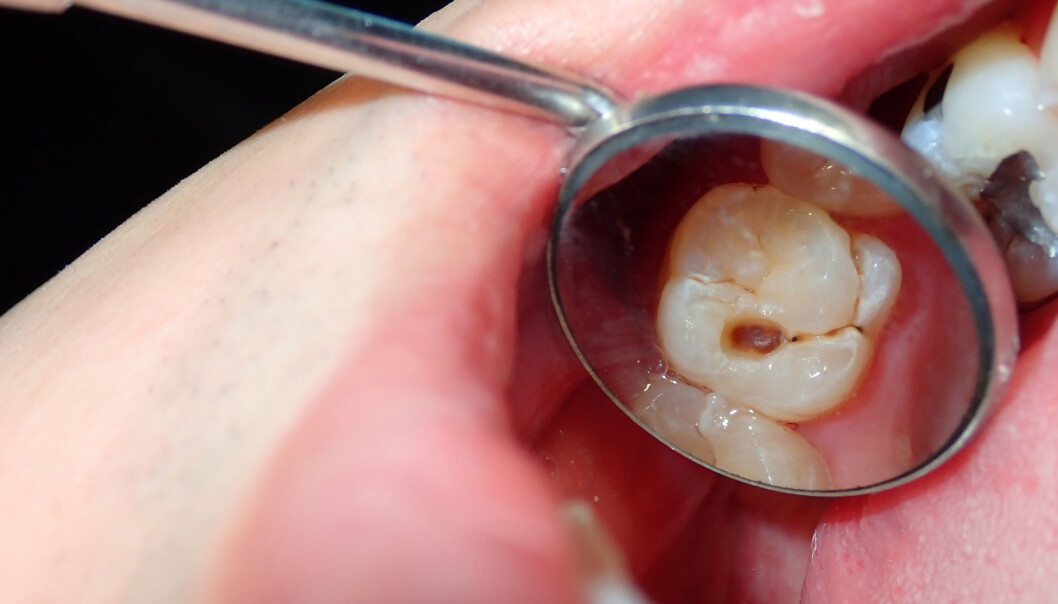 Our genes can affect our oral bacterial flora, saliva production and how strong our tooth enamel is. Our genes can affect our oral bacterial flora, saliva production and how strong our tooth enamel is.