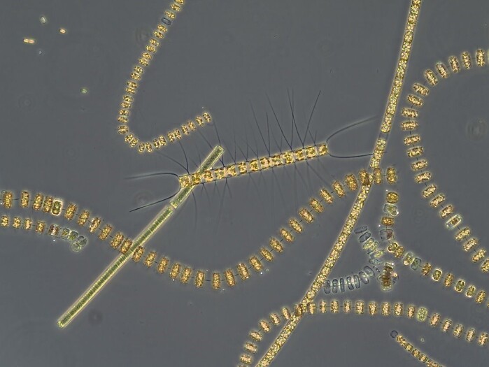 Different chain-forming diatom species typical for the spring bloom under the light microscope Different chain-forming diatom species typical for the spring bloom under the light microscope