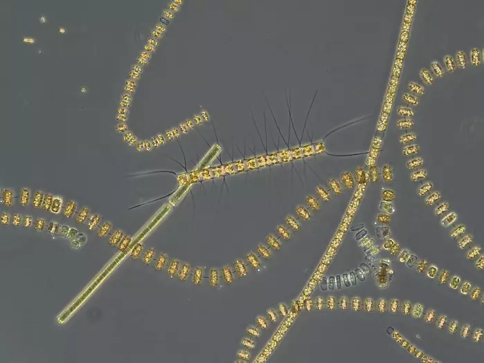 Different chain-forming diatom species typical for the spring bloom under the light microscope