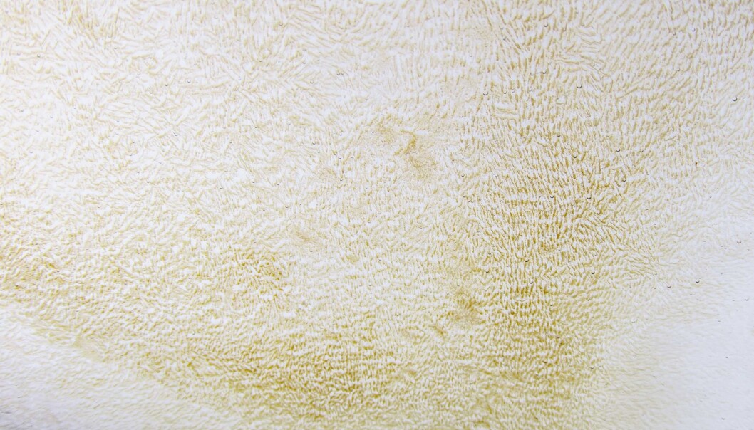 Ice algae growing on the skeletal layer of ice crystals on the underside of sea ice. Ice algae growing on the skeletal layer of ice crystals on the underside of sea ice.