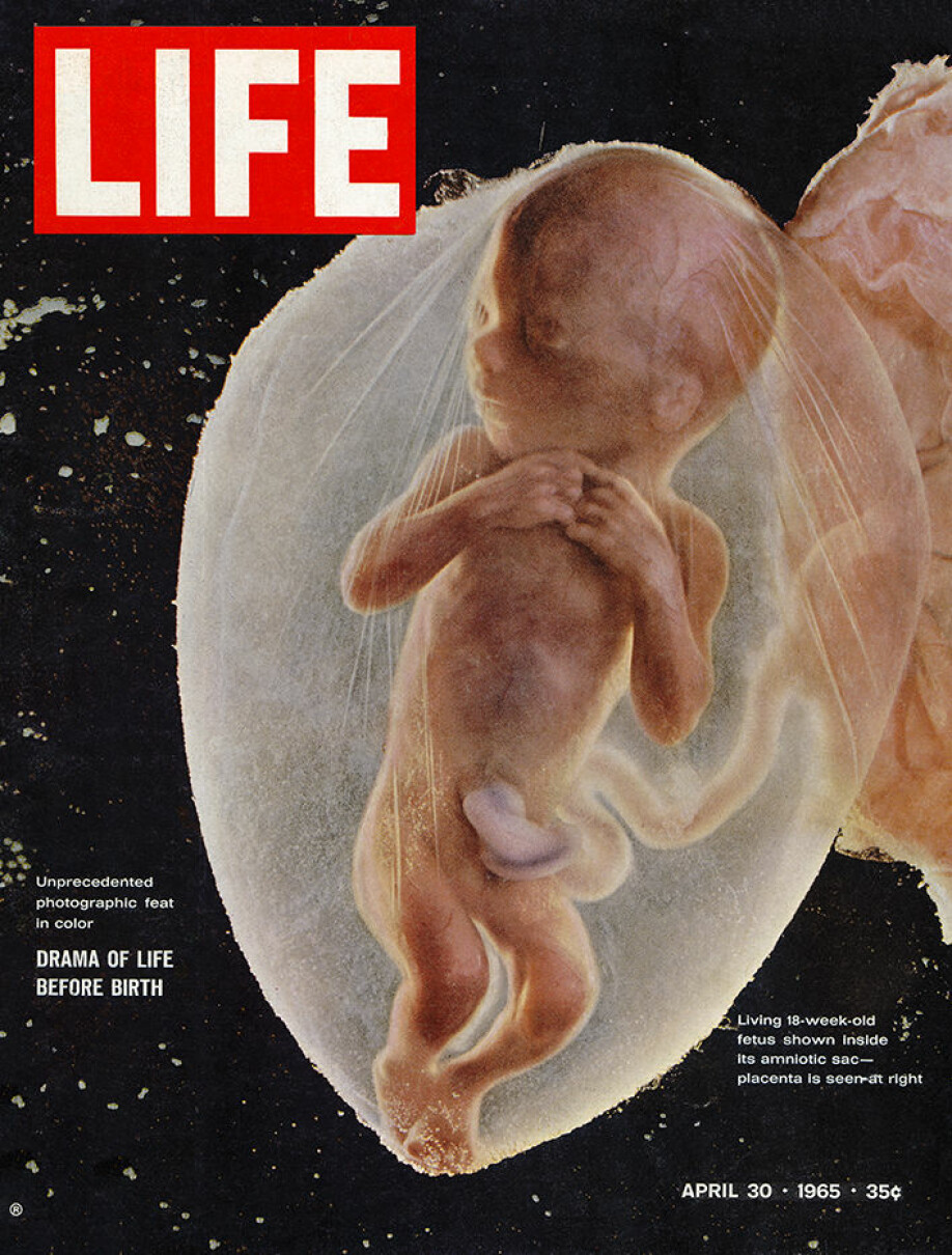 The picture of The Astronaut on the cover of Life Magazine changed the abortion debate in Norway and the rest of the world.
