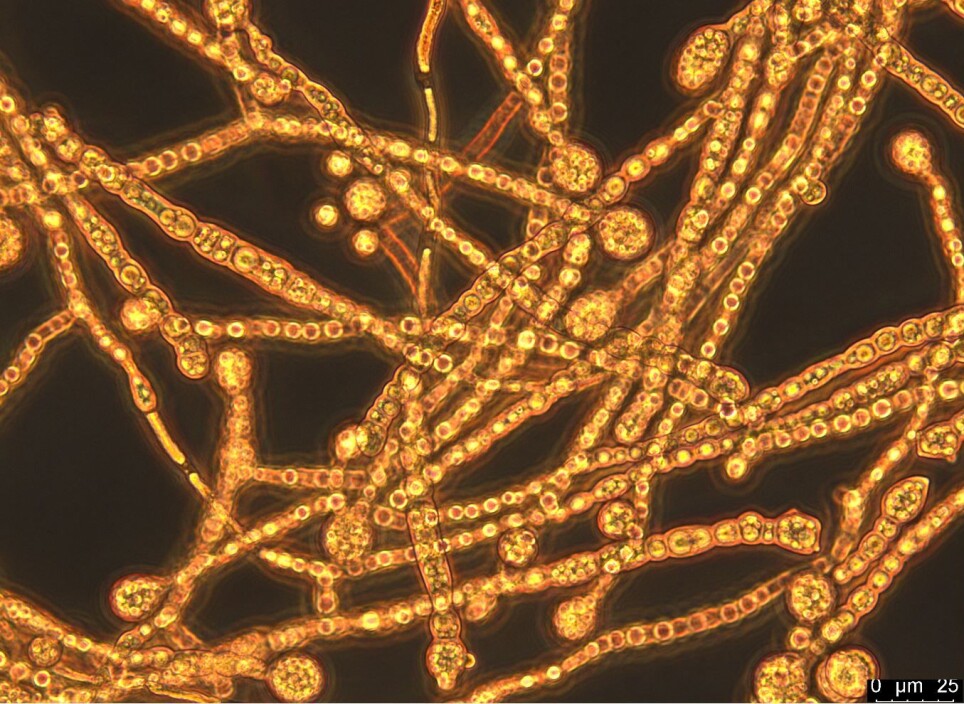 Mucor circinelloides hyphae containing lipid bodies.