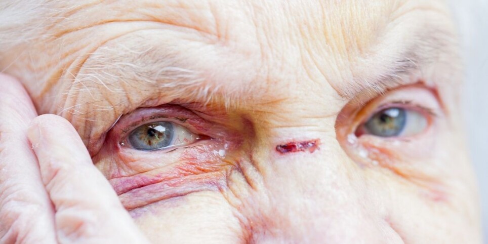 Most people who work in nursing homes have experienced elder abuse.