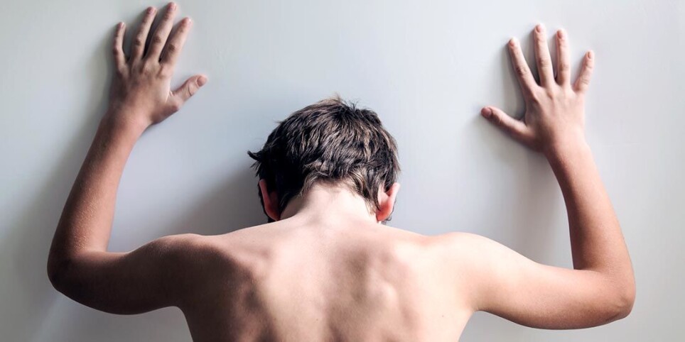 Many young people have such severe eating problems that it poses a risk to their mental health. They also have a higher rate of suicidal thoughts.