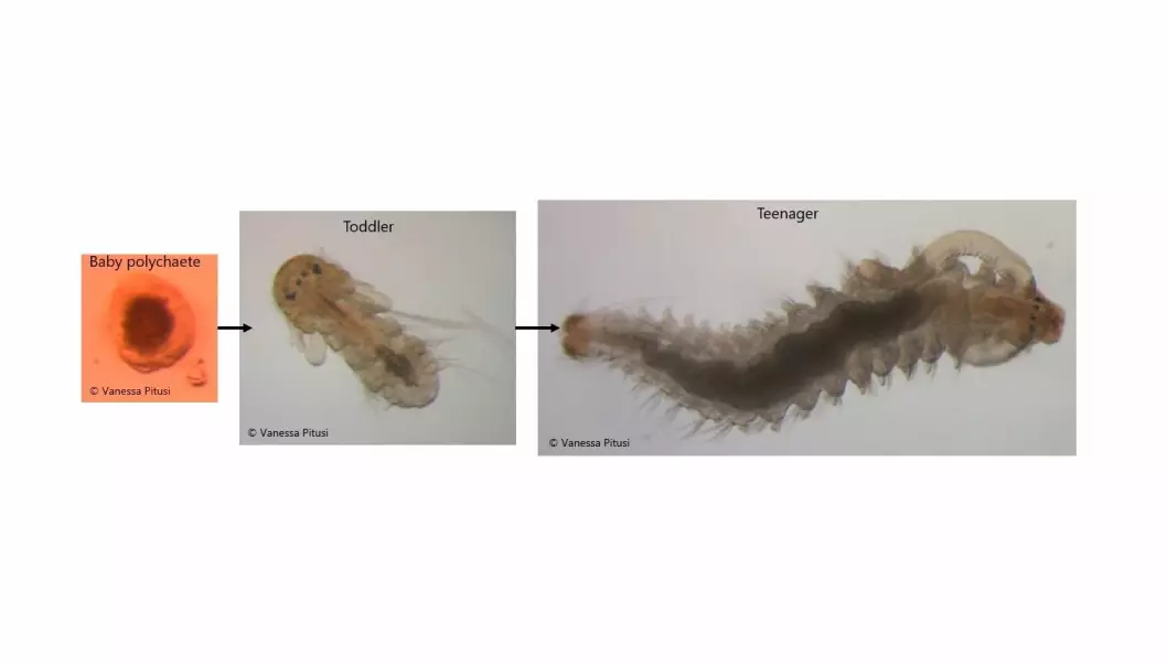 Stages of polychaete development within sea ice; species unknown.