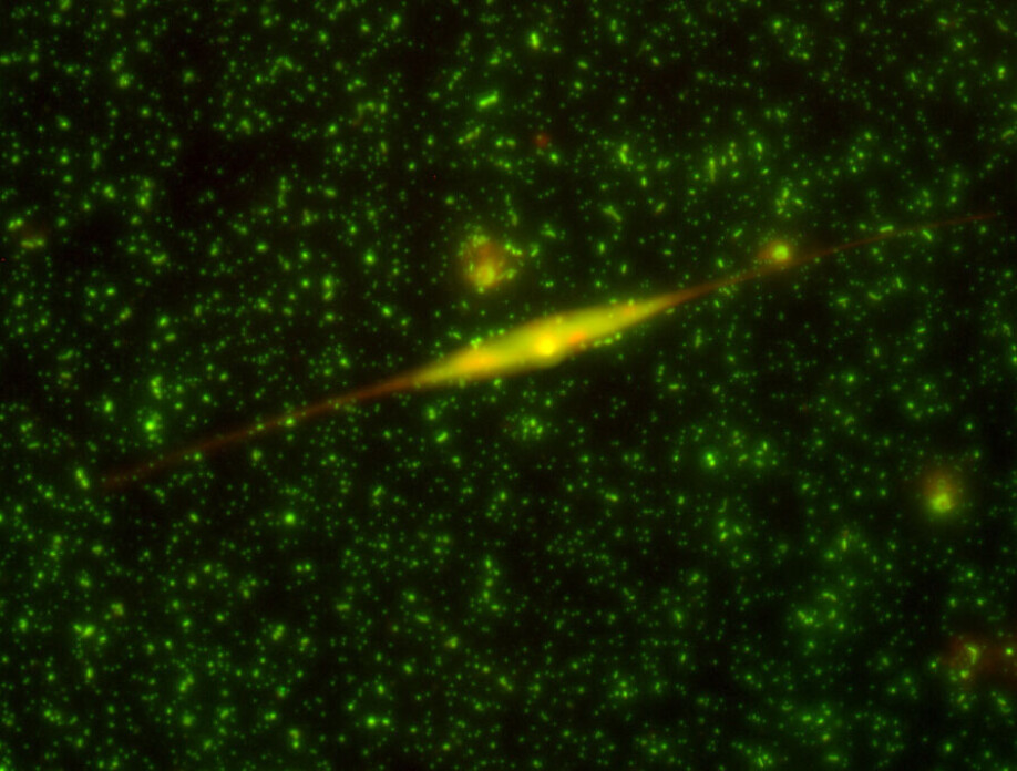 Seawater seen under the microscope with 1000 times magnification – bright blobs are bacteria and the tiny dots are viruses. There are roughly one billion bacteria and ten times more viruses in 1 liter of seawater.