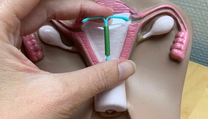 If the contraceptive implant can’t be felt on the surface of the skin, women should be referred to a hand surgeon to remove it. That’s the recommendation of surgeons who have treated two of these kinds of injuries in Norway. If the contraceptive implant can’t be felt on the surface of the skin, women should be referred to a hand surgeon to remove it. That’s the recommendation of surgeons who have treated two of these kinds of injuries in Norway.