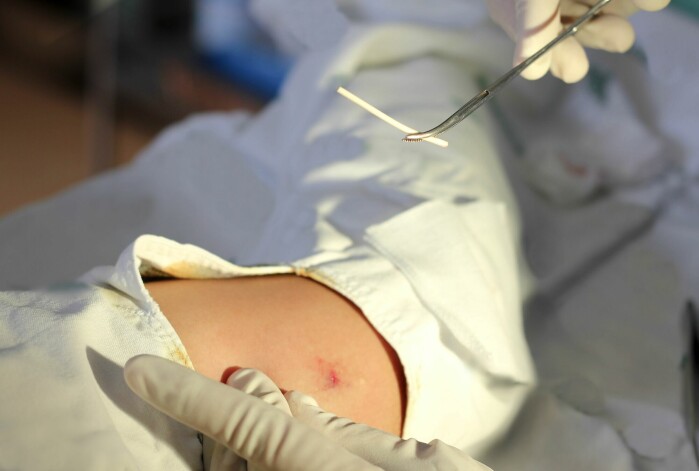 The IUD is inserted into the uterus, where it releases small doses of the hormone progestin. Together with the IUD itself, this prevents a fertilized egg from attaching. The IUD is inserted into the uterus, where it releases small doses of the hormone progestin. Together with the IUD itself, this prevents a fertilized egg from attaching.
