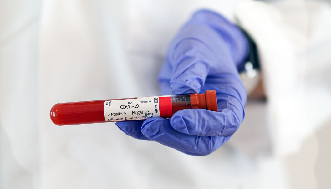 A not yet published study found high levels of antibodies in people who had mild Covid-19, 10-12 months after the infection. A not yet published study found high levels of antibodies in people who had mild Covid-19, 10-12 months after the infection.