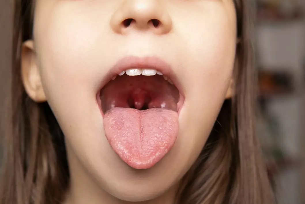 Our tonsils are the shock organ of pollen allergy, according to researcher.