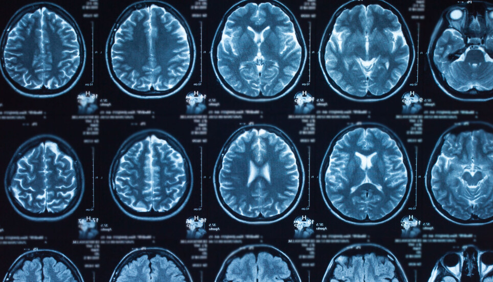 Neuroimaging of the human brain.