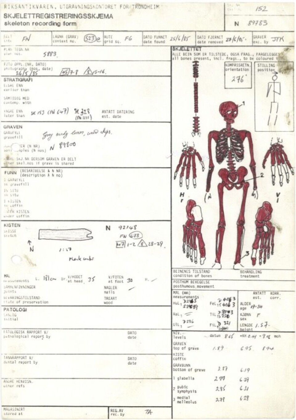 The record for SK152, the skeleton from a woman who died around 1200 — with evidence of a deadly pathogen between her teeth. In an article about her disease, rsearchers called her Ragna.