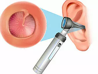 Inside our ear we have a tympanic membrane, or eardrum. It keeps out water, dust and insects, but it’s so thin that we can hear sounds well.