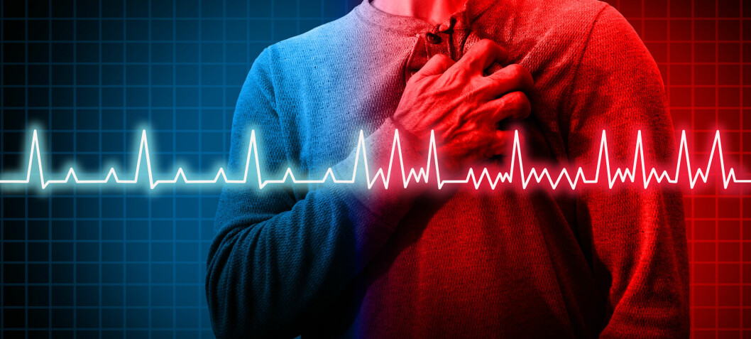 Undetected atrial fibrillation was the cause of many strokes. Nine out of ten had no symptoms