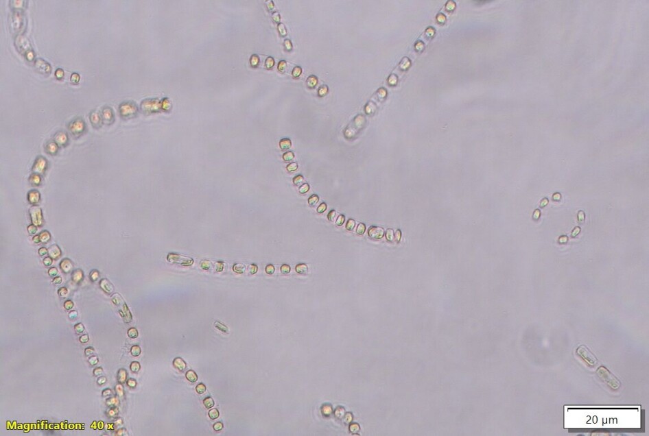 The species Skeletonema marinoi has several of the properties needed to grow in wastewater. In addition, the species has a favorable nutritional profile that fits well with the salmon's needs. This is one of the species Borg-Stoveland will take a closer look at in his research