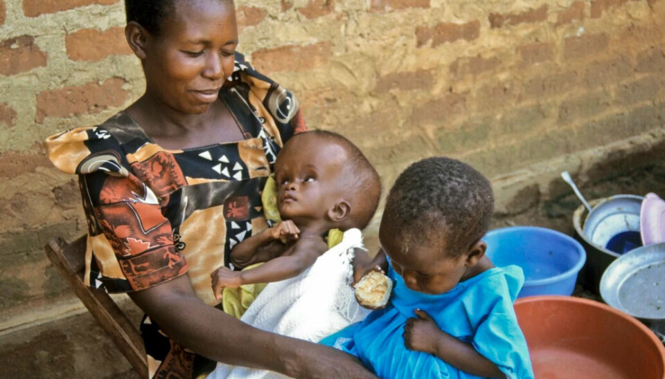 “Children with hydrocephalus have too much brain fluid in their heads, causing the heads of the youngest children to grow,” Camilla Aukrust says.