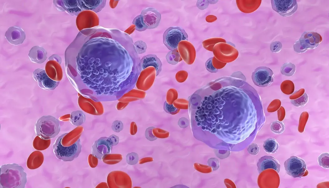 Acute myeloid leukemia cells take the place of healthy white blood cells. Norwegian researchers may now have found a new treatment, but it is yet to be tested in humans.