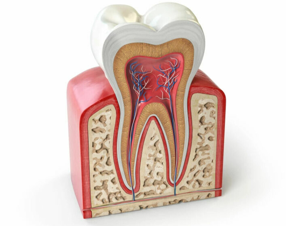 This is the anatomy of a tooth. The white layer on the outside is the enamel. It has the same thickness as a finger nail, but is very hard. The brown on the inside is the dentin, which is softer. Inside is the pulp, which consists of tiny blood vessels and nerves.
