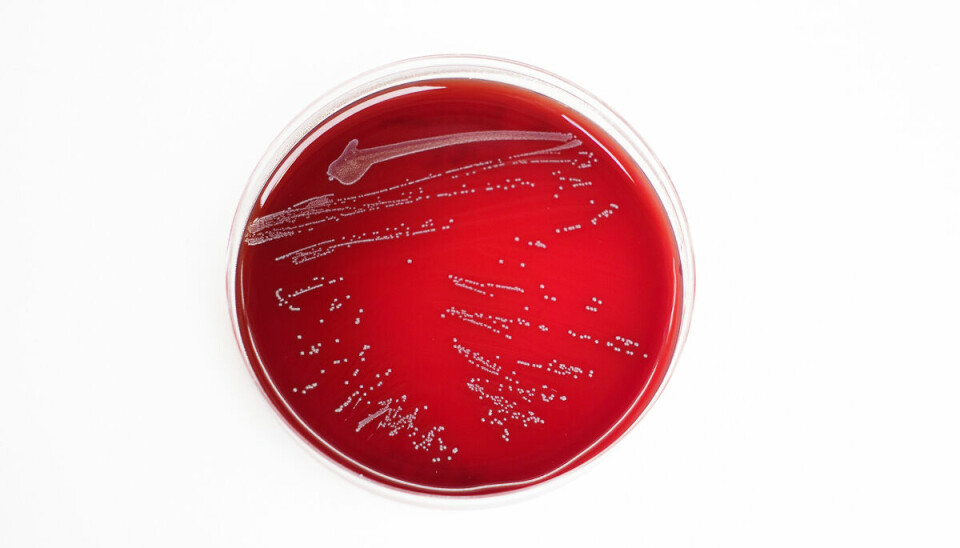 Bacterias are grown and studied in a petri dish.