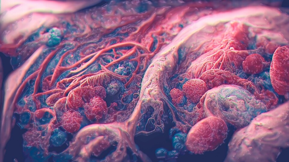 Artistic illustration of cancer in the body.