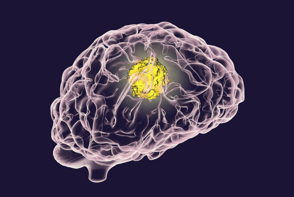 Researchers are looking for better treatments for brain cancer.