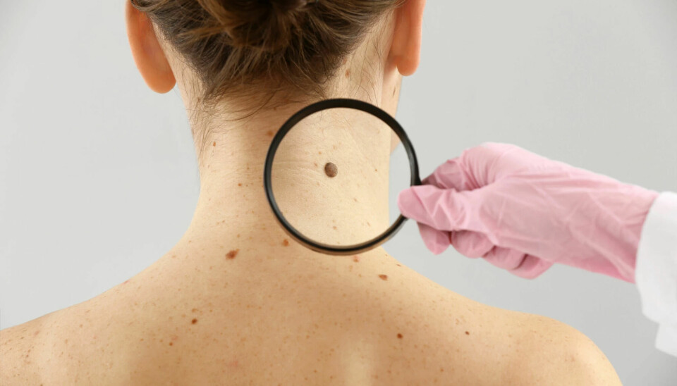 The incidence of melanoma is increasing.