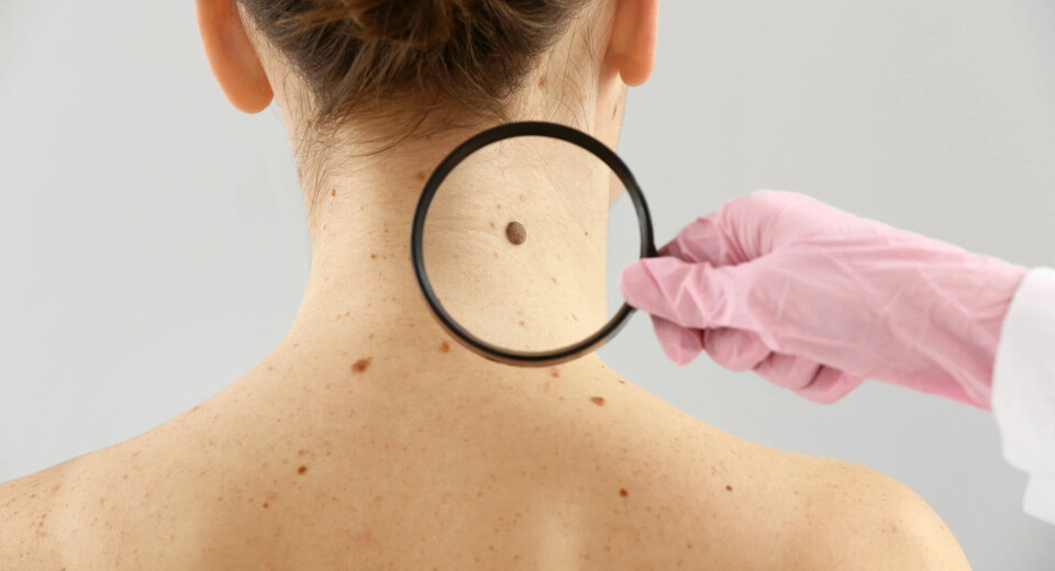 Dramatic increase of skin cancer in Norway - is the pandemic to blame?