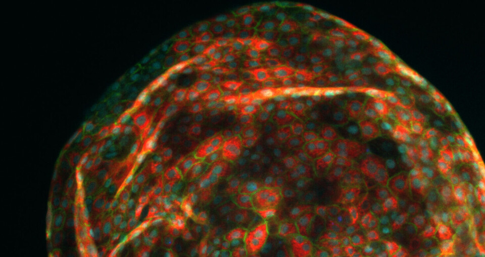 Organoids of liver cells.