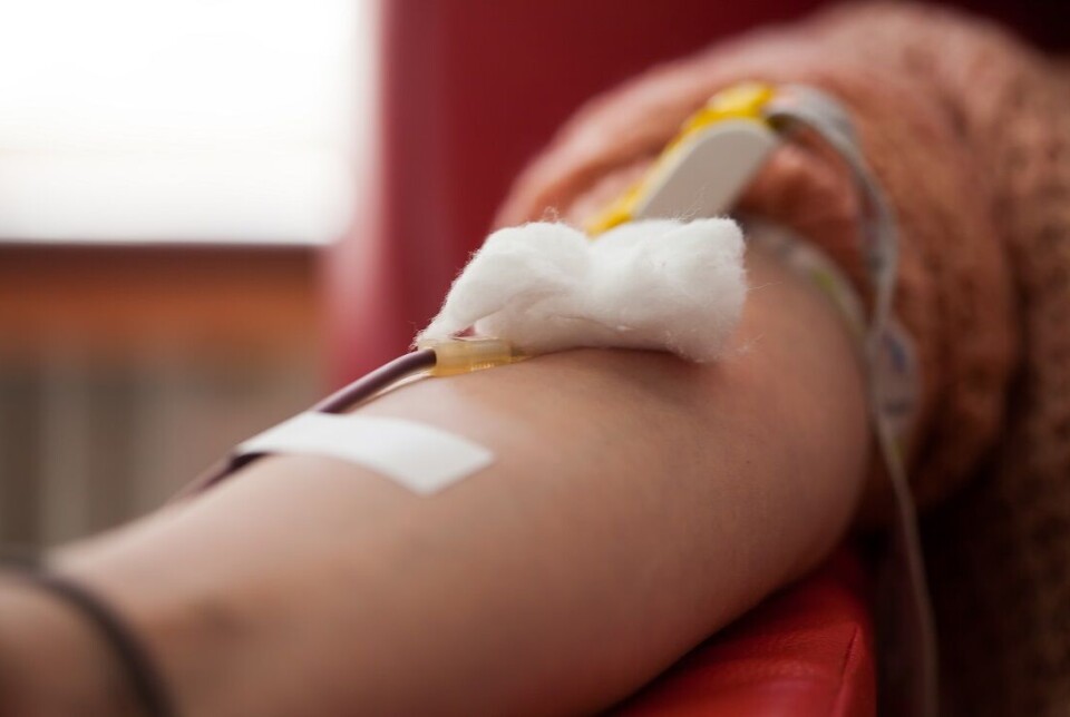During the pandemic, the number of sepsis patients decreased. But more people died if they got sepsis as a result of Covid-19.