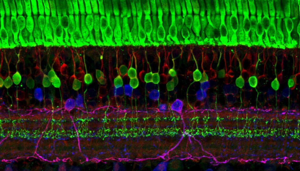 Here you can see an image of the many layers of the retina. Can you see the cones and rods?