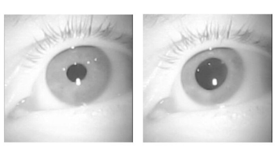 The eye of an elite rower while sitting still (left) and while using a rowing ergometer (right).