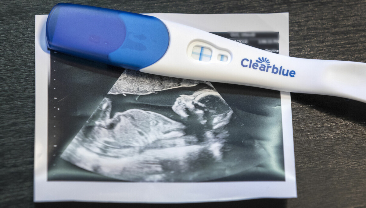 Stadig flere kvinner velger abort etter påvisning av kromosomavvik