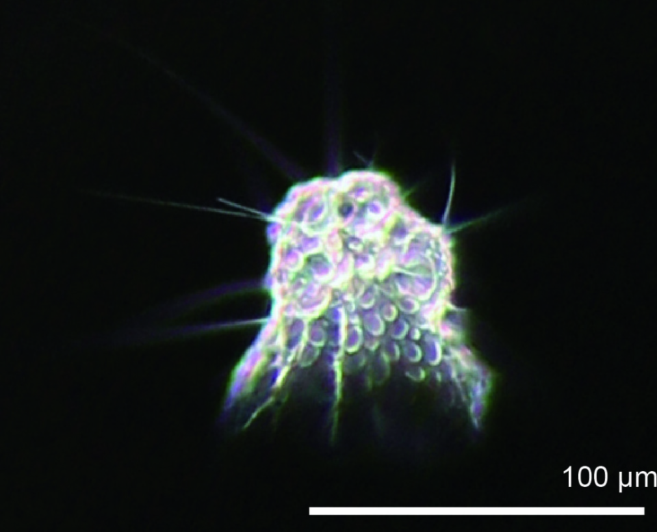 A dark field micrograph of Amphimelissa setosa taken from sinking particle in the Arctic Ocean (Chukchi Sea)