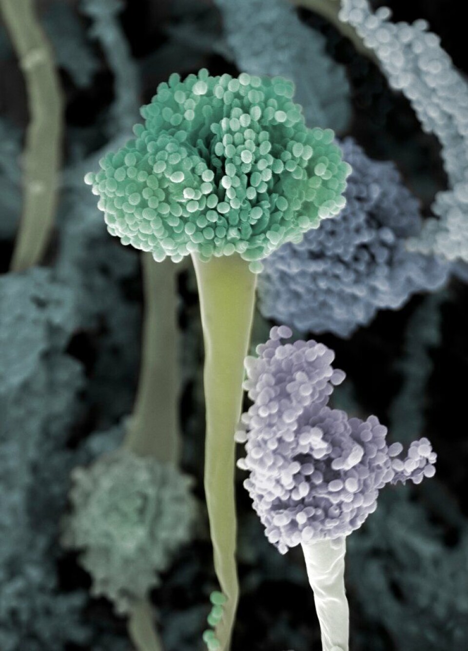 WHO has chosen the fungus Aspergillus fumigatus as a fungus that can pose a health threat in the future. This is what the fungus looks like under an electron microscope.