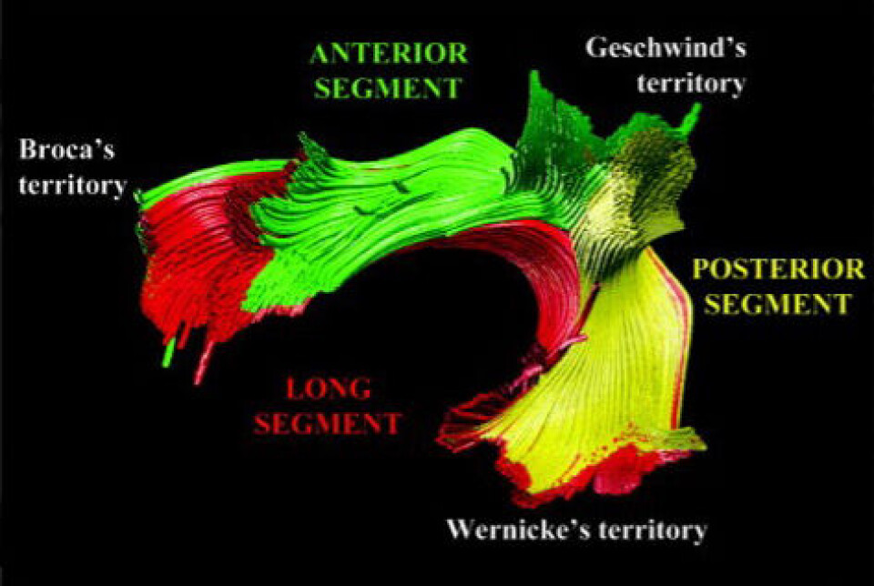 The arcuate fasciculus plays an important role in the brain’s ability to process and learn language.