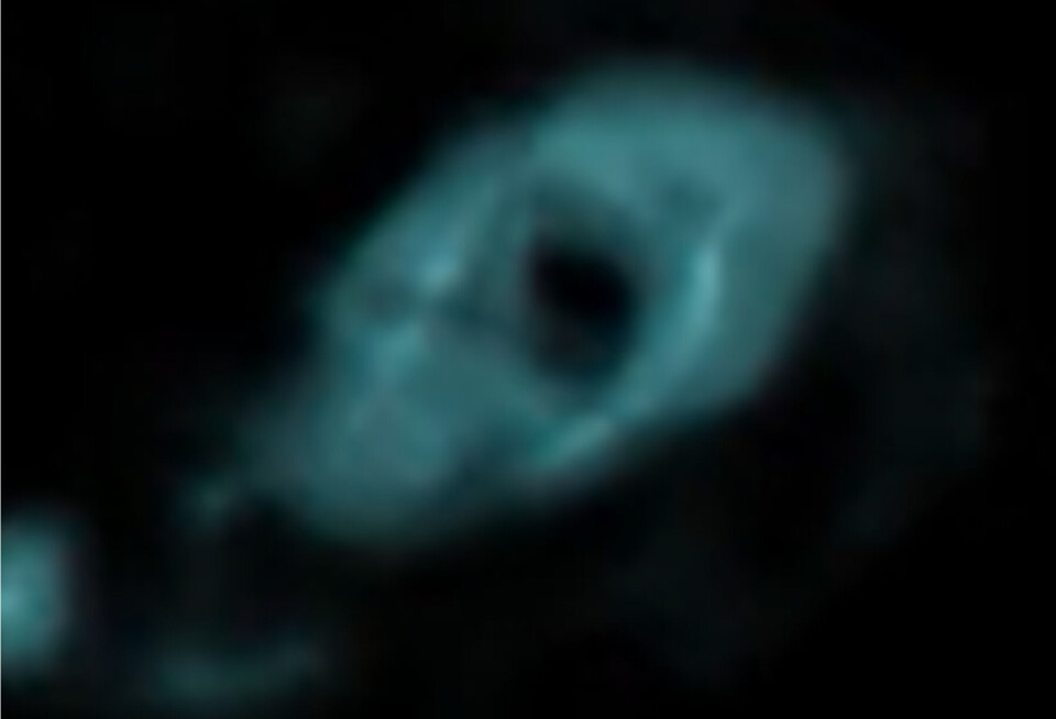 Here's the doughnut. The contrast agent injected into the spine lights up on an MRI image of one of the study participants' brain. The luminous cerebrospinal fluid encircles a blood vessel (black ring in the middle) on its way into the brain. Et MR-bilde viser en smultringformet lys ring med et svart hull i midten.