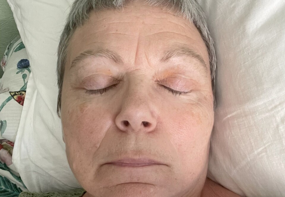 “All activity, whether physical, cognitive, or emotional, depletes the little energy I have,” says Kari Cotton, 61, who has had ME for eight years. If it’s too much, she gets PEM. Then she can be bedridden for several days, with chills, tremors, pain, and sleep problems. Nærbilde av en middelaldrende kvinne med lukkede øyne som hviler hodet på en hvit pute.