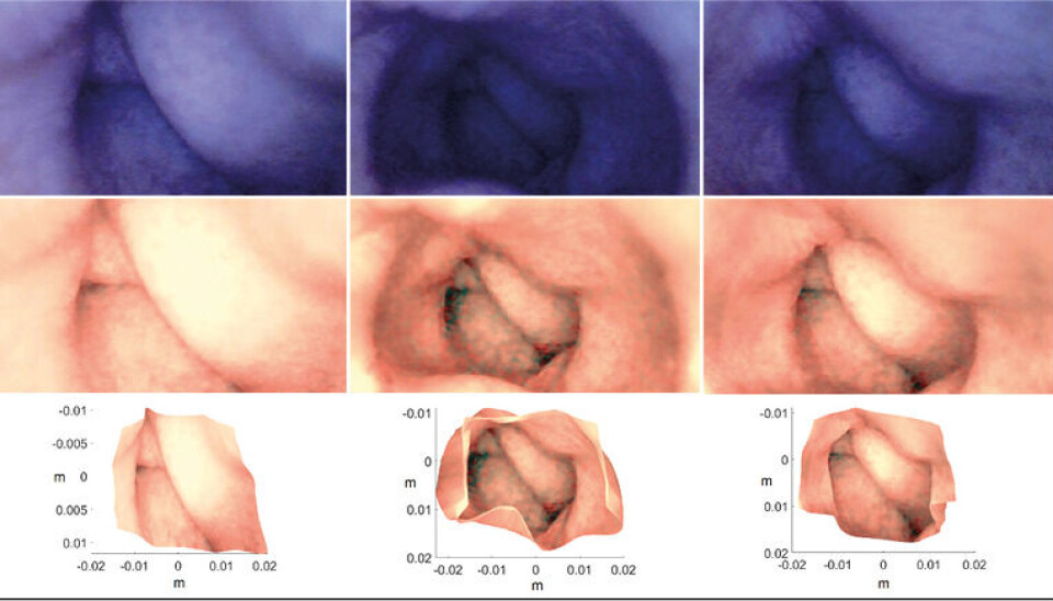 Top: Three original images from an artificial colon, taken using an endoscope. Middle: The original images after colour correction and light adjustment, revealing many more details. Bottom: The reconstructed 3D model based on the three originals.