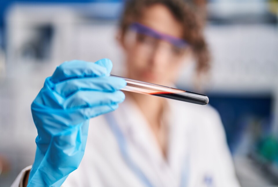 Several studies show that traces of PFAS in the blood can have negative health effects. Kvinne i laboratorieklær holder opp et reagensrør med blod.