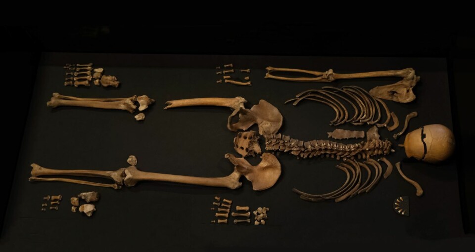 The skeleton that was found in the well at Sverresborg in Trondheim. Skjelett