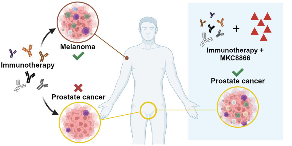 Melanoma is a hot tumor, and checkpoint inhibitors alone can cure it. However, for prostate cancer, checkpoint inhibitors alone do not work. Combining checkpoint inhibitors with MKC8866, however, has shown significant effects in preclinical models.