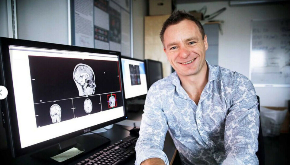 “Our research indicates that what happens early in life, and not just genetic factors, often has a much greater effect than what happens later in life,” says Anders Martin Fjell.