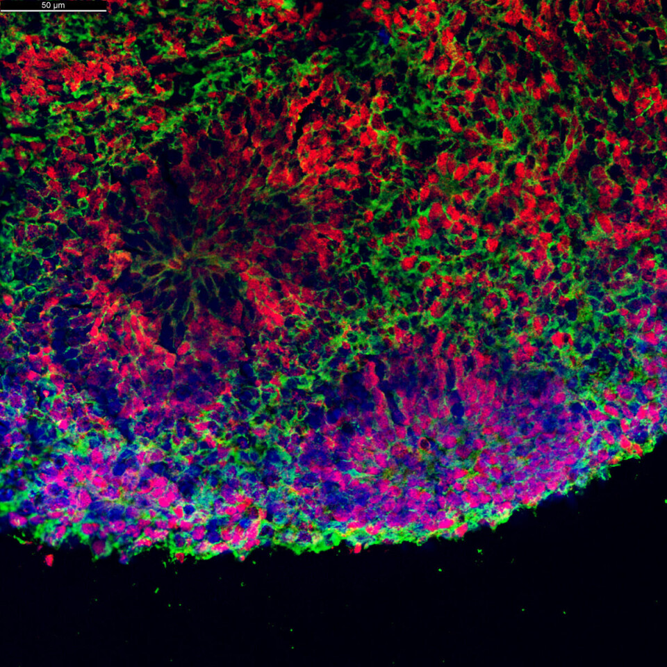 The image shows what mini-brains look like when magnified under a microscope.