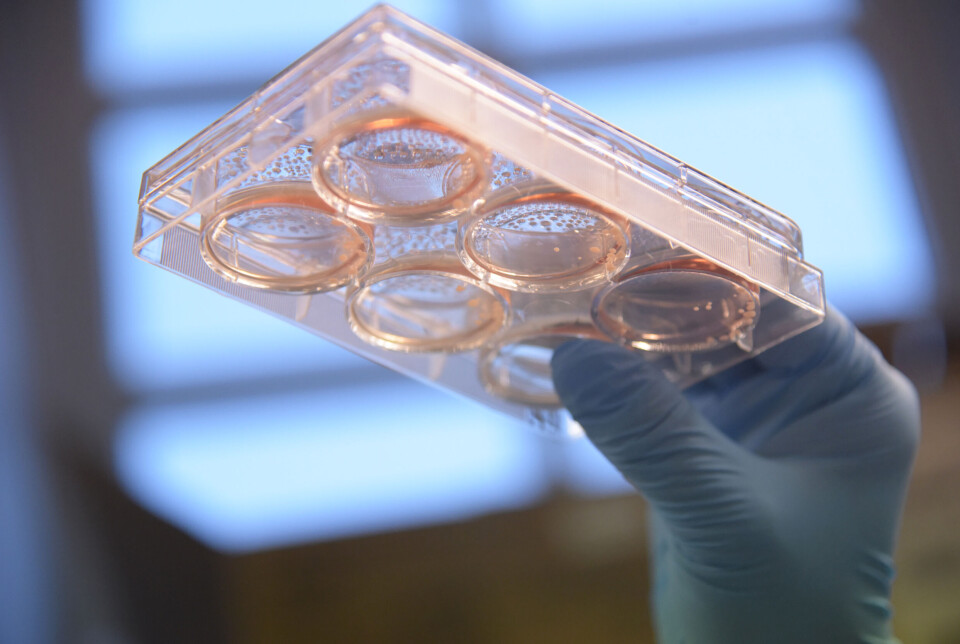 To build the mini-brains, the scientists coax clusters of stem cells into becoming neurons and other brain cells. This offers a unique tool for studying human brain development and the effects of disorders.