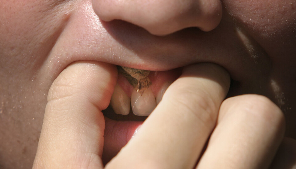 Dentists are mostly able to tell whether you use snus or not.