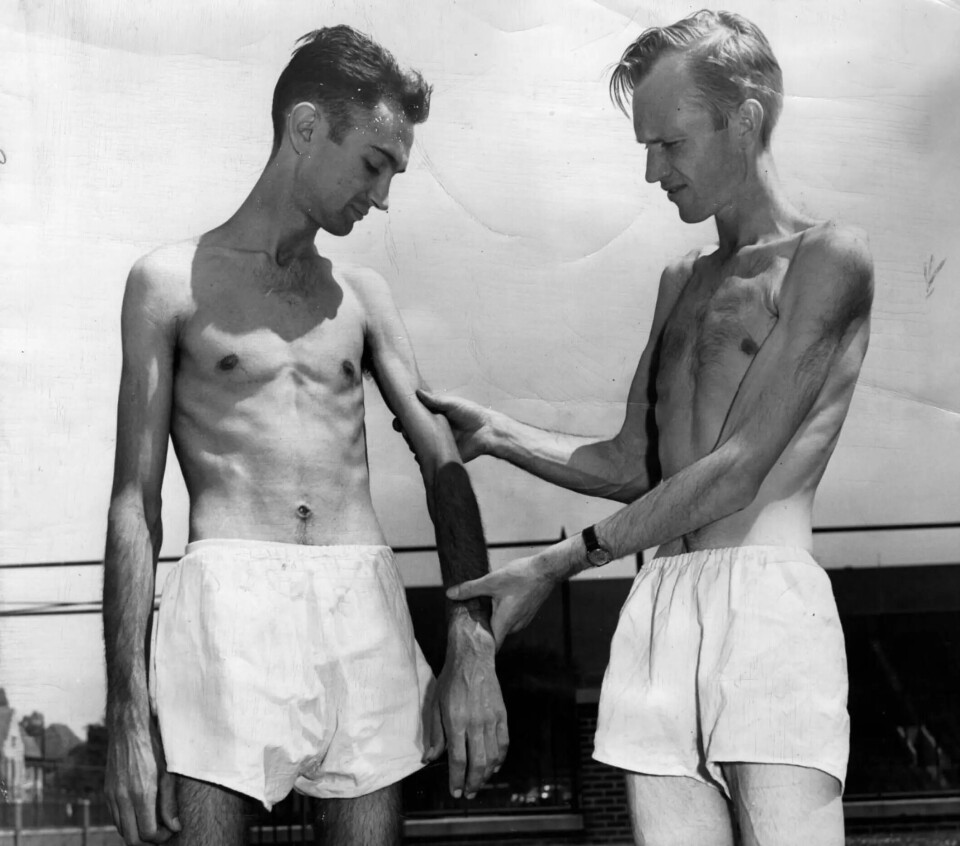 The participants in the experiment eventually became severely emaciated, and their personalities changed. They became more irritable and socially withdrawn. Some developed a distorted perception of what constituted a normal weight.