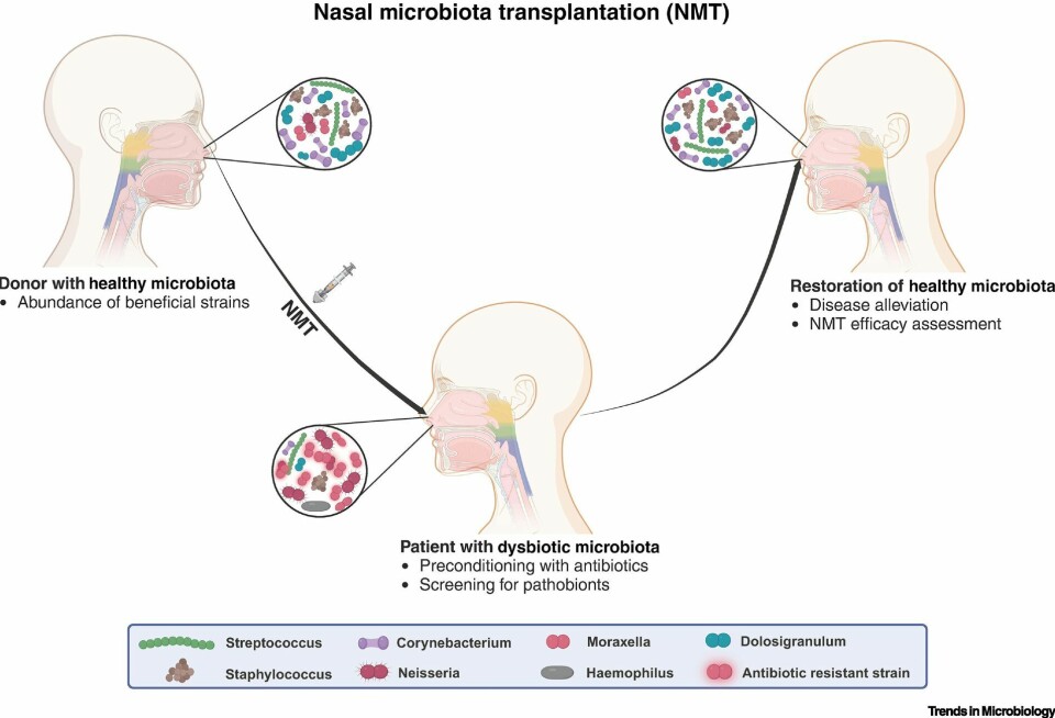 This image shows how healthy nasal microbiota can be restored through donor transplantation.