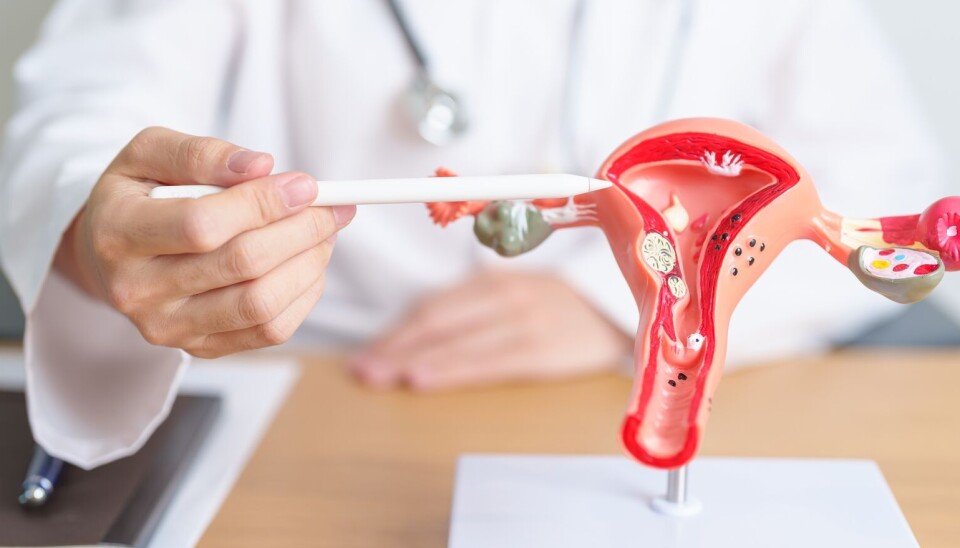 This model illustrates a woman's internal reproductive organs. It includes the vagina, uterus, ovaries, and fallopian tubes.